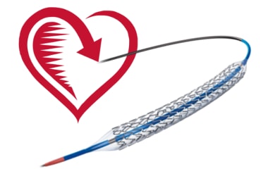 Capped Prices of Coronary Stent - Pros and Cons