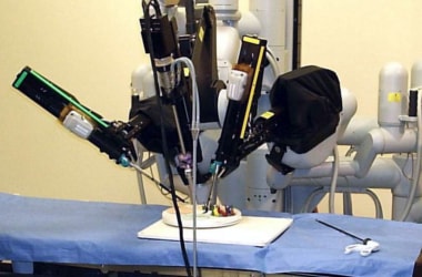 Meet Versius, the world’s smallest surgical robot