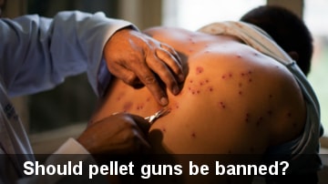 Should pellet guns be banned?