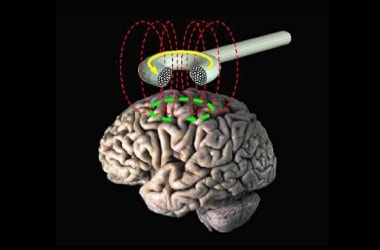 Magnetic stimulation can revive forgotten memories: Scientists