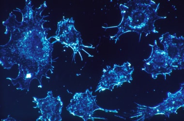 Scientists slow down cancer cell growth