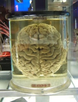 Largest collection of preserved human brains in Belgium