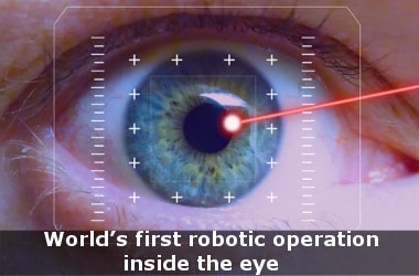 World’s first robotic operation inside the eye